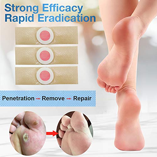 Corn Remover Pads Wart Remover Pads, Eliminar Verrugas, Eliminación de Callos, Tratamiento Anti Verrugas Tratamiento para Quitar Verrugas Comunes y Plantares (24 PCS/Box)
