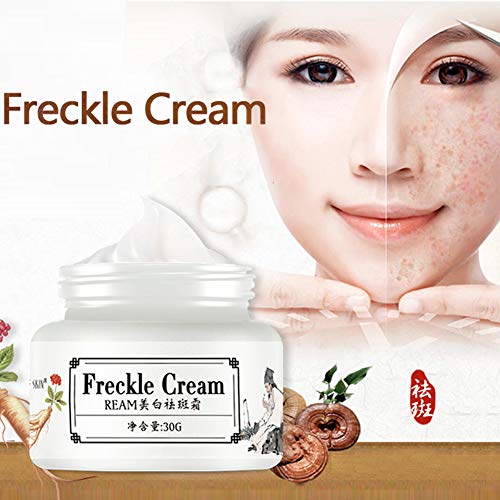 Crema blanqueadora Crema para aclarar la piel Punto oscuro Corrector Removedor Hidratante Aclarar Color de la piel Crema para pecas Yiitay