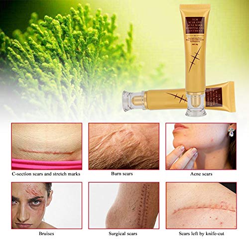 Crema para Eliminar el Acné de La Cicatriz,Ayuda a Remover Espinillas, Granos en Cara O Cuerpo, Anti Imperfecciones Facial y Corporal, Hombre/Mujer, Adolescente, Juvenil,Piel Grasa y Mixta