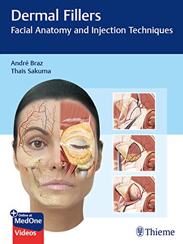 Dermal Fillers: Facial Anatomy and Injection Techniques (English Edition)