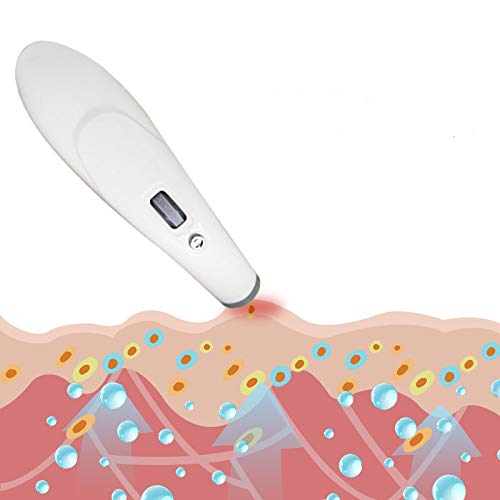 Dispositivo Para Aliviar Las Picaduras De Mosquitos, Eléctrico Para Picazón De Alivio Mosquito Instrumento, Para La Quemazón El Dolor Y La Hinchazón De Las Picaduras, Totalmente Libre De Sustancias Qu