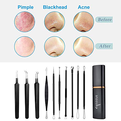 Extractor de Puntos Negros y Espinillas Profesional Kit, 10PCS Aguja Extractor Limpiador para Puntos Negros, Espinillas, Comedones, Acné Remover en Cabeza Doble de Acero Inoxidable (Negro)