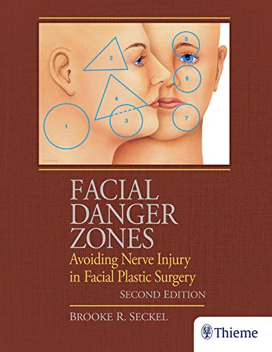 Facial Danger Zones: Avoiding Nerve Injury in Facial Plastic Surgery (English Edition)
