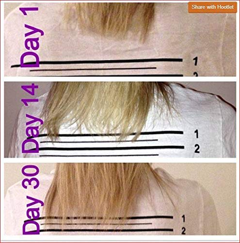 FAST Champú + Acondicionador - El mejor champú para el rápido crecimiento del cabello. Champú estimulante con biotina (de Canada) - 1 litro