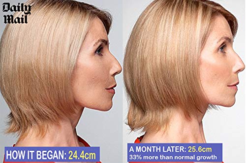 Fast SLS y parabenes Champú y Acondicionador + cuero cabelludo cepillo de masaje