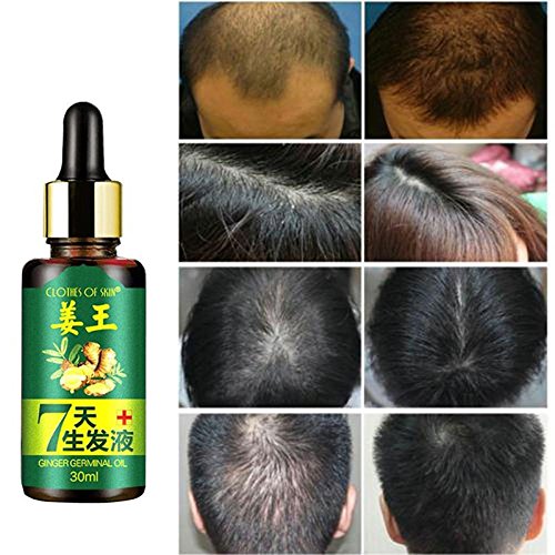 Hair Growth Serum,Anti Hair Loss,Hair Growth Serum, Natural Herbal Essence Anti Hair Loss Hair Serum,Hair Growth Hair Thickening