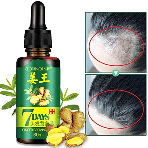 Hair Growth Serum,Anti Hair Loss,Hair Growth Serum, Natural Herbal Essence Anti Hair Loss Hair Serum,Hair Growth Hair Thickening