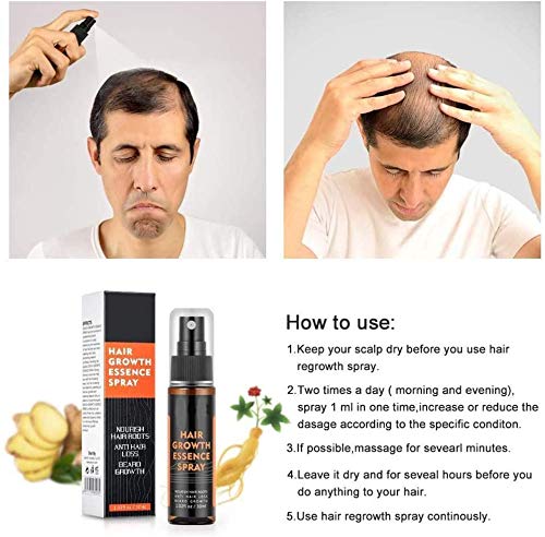 Hair Regrowth Essence Intensive Spray, Natural Ingredients Hair Regrowth Anti-Loss Hair Fluid Used for Anti Hair Loss, Wake up The Scalp and reproduce Thick Hair, for Men for Women