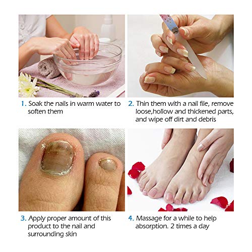 kkkl Vibrant Glamour Nail Care Crema de reparación de uñas, restaura Las uñas decoloradas y dañadas