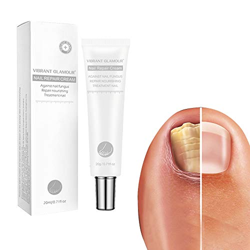kkkl Vibrant Glamour Nail Care Crema de reparación de uñas, restaura Las uñas decoloradas y dañadas