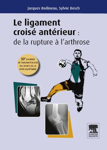 Le ligament croisé antérieur : de la rupture à l'arthrose: 30e journée de traumatologie du sport de la Pitié (MA.MED.MANU/SPO) (French Edition)