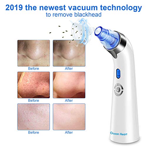 Limpiador de Poros, Ocean Heart Extractor Puntos Negros Eléctrico Limpiador Facial, Aspirador de Puntos Negros Exfolia la piel muerta Facial de Belleza con Pantalla LED Para Tratamiento Facial