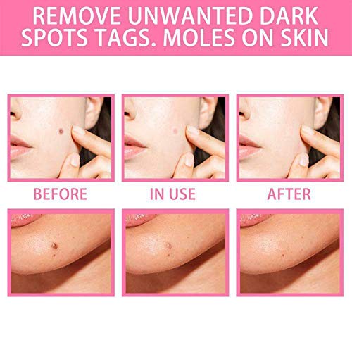 LLSS 20ml Organic Tags Solutions Serum Original,Painless Mole Skin Dark Spot Repair Instant SkinTag and Mole Remover (2pcs)