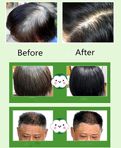 MQFORU - Tinte instantáneo para el cabello para hombres y mujeres, color negro, fácil de usar, dura 30 días, ingredientes naturales