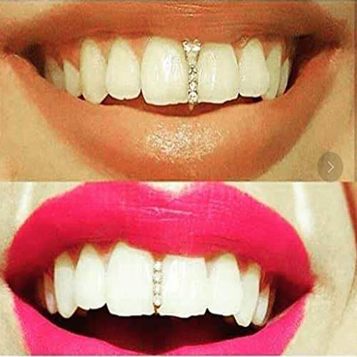 N\ A Frenos De Hip Hop, Diamond-Single Bar Shape Teeth, Hip Hop Teeth Grills Gold-Plated Braces Diamond Braces Single Braces for Party 1.1x0.7x0.2cm / Pistola de Color Negro