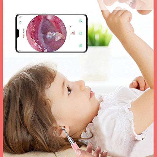 NBHUYT Examen de la cámara 3.0mm Cinco Millones de píxeles de Alta definición con 6 LED de luz fría AI Control de Voz, Elegir el Color, Blanca (Color : Pink)