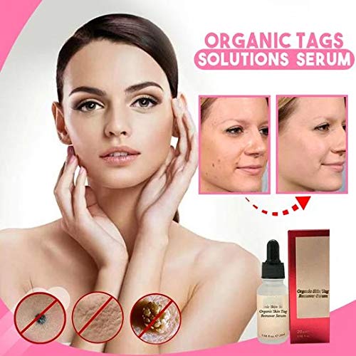 Organic Tags Solutions Serum, Mole & Skin Tag Repair Solution Painless Mole Skin Dark Spot Repair Face Wart Tag Freckle Repair Cream Oil (20ml)