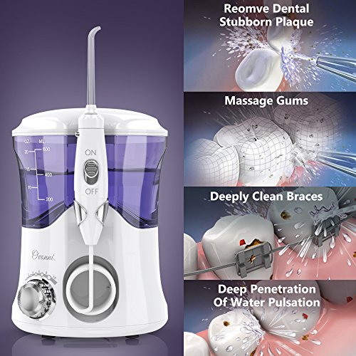 Ovonni Irrigador Dental Profesional, 7 Boquillas Intercambiables, 10 Ajustes de Presión, 600 ML de Gran Tanque de Agua, Cuidado Familiar, Regalo Día de Madre, Blanco