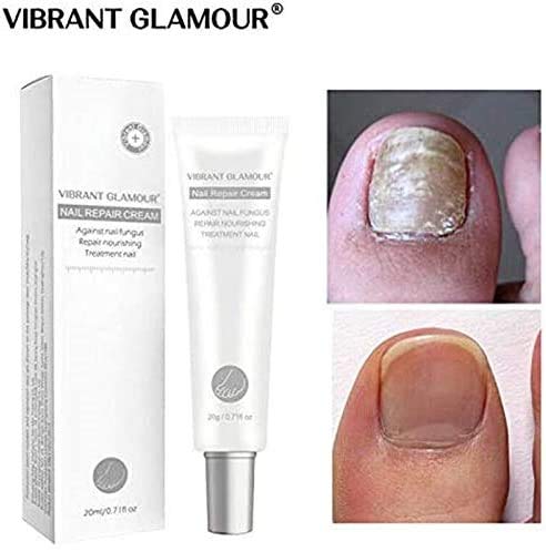 PLMNKO Vibrant Glamour Nail Repair Cream（20g） Nail Repair Correction Gel Treat onychomycosis to Remove Fungus (2pcs)