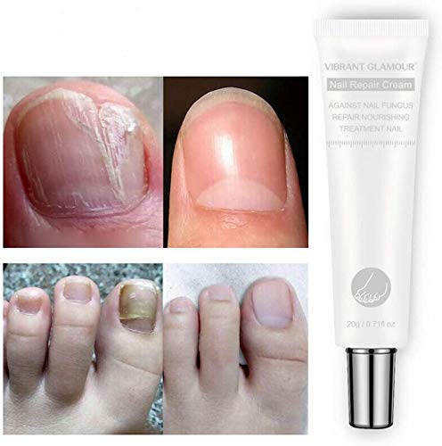 PLMNKO Vibrant Glamour Nail Repair Cream（20g） Nail Repair Correction Gel Treat onychomycosis to Remove Fungus (2pcs)