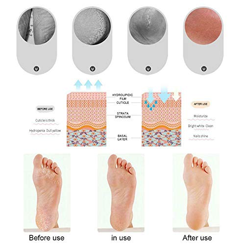 RHTR 2 Pares de Calcetines Hidratantes de Silicona, Calcetines Anti-Secos y anti-Agrietamiento para pies que Rejuvenecen la piel Protegen Suelas y Talones (Blanco sin agujeros)