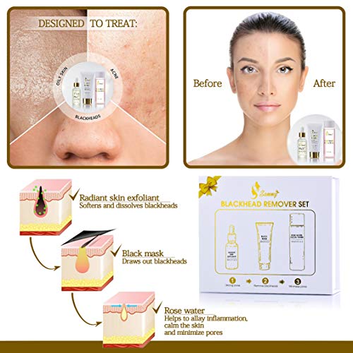 Sammy black removedor set de envoltura de regalo, 1x 3% BHA y AHA Radiant Skin Exfoliant, 1x máscara negra, 1x agua de rosas