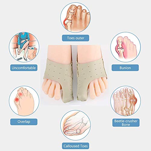 SLRMKK Corrector de juanetes Ultra Delgado, Alisador de Punta elástico, Órtesis de Hallux valgus Ajustable para Dedos superpuestos, Zapatos usable Beige 1 par-L ： 37-39