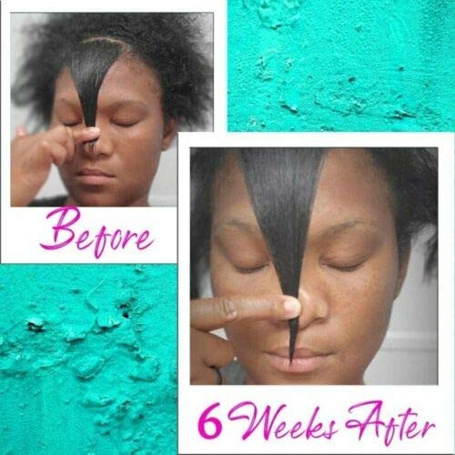 Snowing 2PCS Anti Hair Loss Hair Serum,Hair Regrowth Serum Hair Care Essential Oil Treatment for Soft Hair Pure