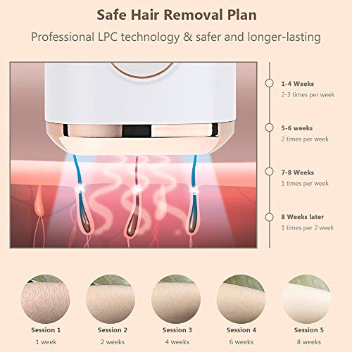 Solución de depilación para mujeres, 999,999 Flashes in-Home permanente IPL Hair Remover Solution para cuerpo facial (blanco)