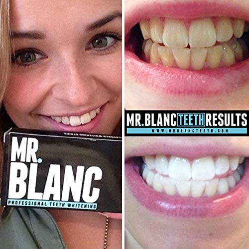 Sr. Blanc dientes tiras de blanqueamiento - Pack de 2 semanas de suministro