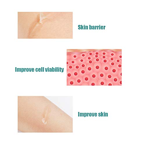 Tratamiento de cicatrices para heridas y ungüentos curativos Suero Aceite para cicatrices Reduce la piel vieja y reparadora Puede usarse en cualquier parte del cuerpo El mejor tratamiento para