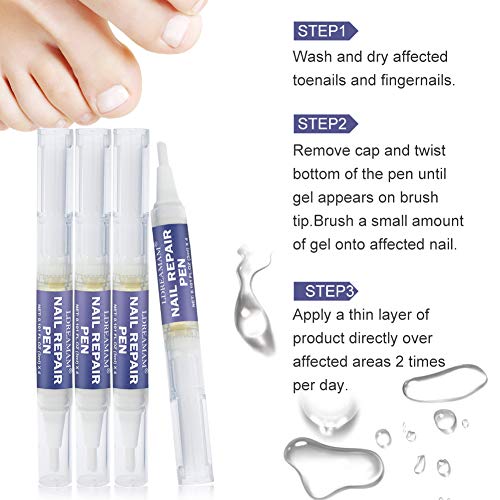 Tratamiento de Uñas,Hongos Uñas Pies,Nail Fungus,Hongo Uñas Tratamiento,Retirar Dedos Infectados Amarillos, Cuidado de Uñas Seguro y Natural