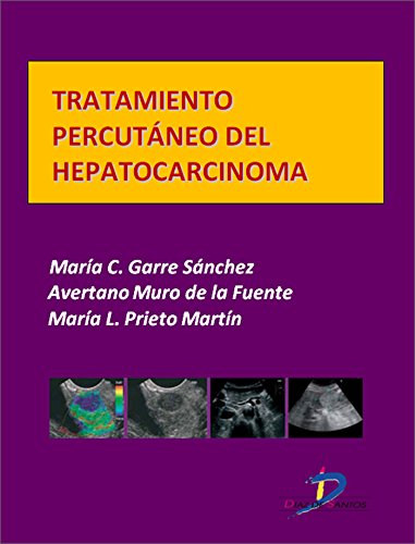Tratamiento percutáneo del hepatocarcinoma  (Este capítulo pertenece al libro Tratado de ultrasonografía abdominal)