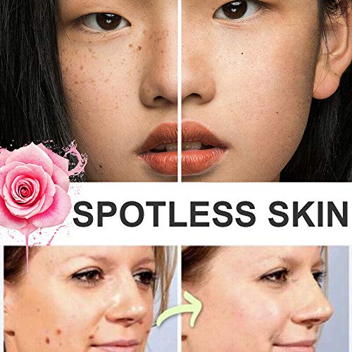 TTCPUYSA Organic Skin Spot Purifying Serum All Natural Tags Free Mole & Tag Removal Dark Spot Corrector Serum (2 pcs)
