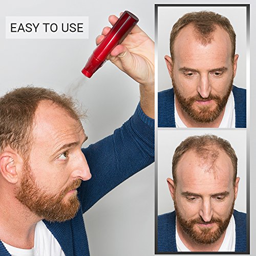 VidalForce, Fibras Capilares Premium (Castaño Oscuro)  40gr