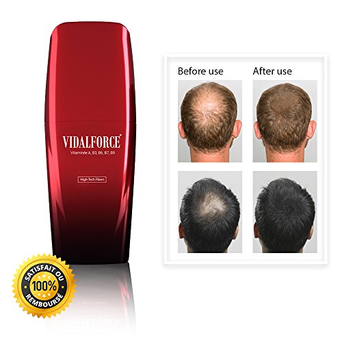 VidalForce, Fibras Capilares Premium (Castaño Oscuro)  40gr