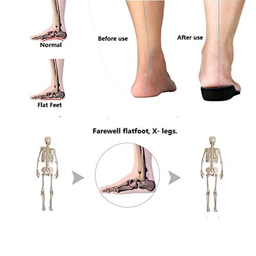 WSN Plantillas de Soporte de Arco Plantilla ortopédica, ortesis de Soporte de pie Plano para la Fascitis Plantar para aliviar el Dolor de talón, Unisex 1 par,L