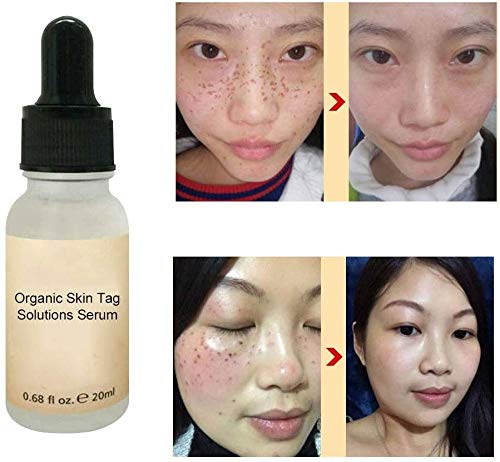 ZHive Organic Skin Spot Purifying Serum 2PCS, All-Natural Skin Tag Repair Cream Removal Tags Mole
