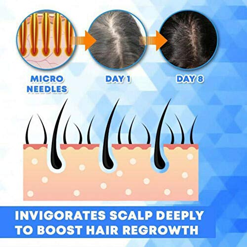 ZZSNT Hair Regrowth Activating Roller, Micro-needling Roller Beard Growth Product Anti Hair Loss