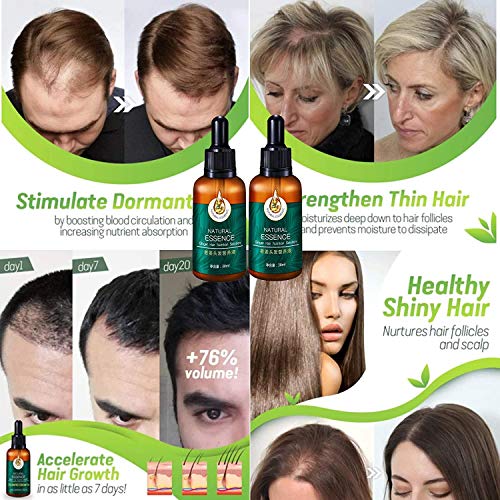 1pc/2pcs/3pcs 7X Rapid Growth Hair Treatment, 7 Day Hair Growth Serum Essence Oil Regrow, Anti Hair Loss Fast Hair Growth Serum Ginger Essential Oil Promotes Thicker and Regrowth (30ml)