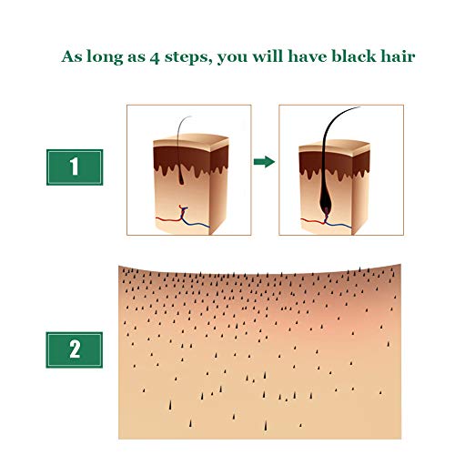 Aceite para Crecimiento del Cabello Pelo Crecimiento Esencia Hair Growth Essence 100% Pure Nature Estimula el Crecimiento Cabello para Hombres y Mujeres