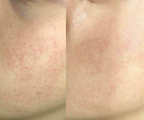 Alya Skin - Máscara de arcilla rosa australiana (120 g) tarro único