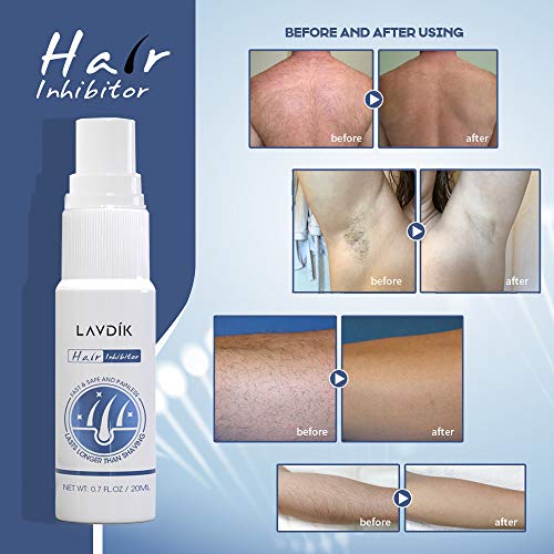 Anself Spray supresor de cabello 20ml Spray inhibidor de cabello Depilación sin dolor e irritación Adecuado tanto para hombres como para mujeres