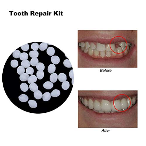 Artibetter Kit de reparación de Dientes Temporal (Blanco)