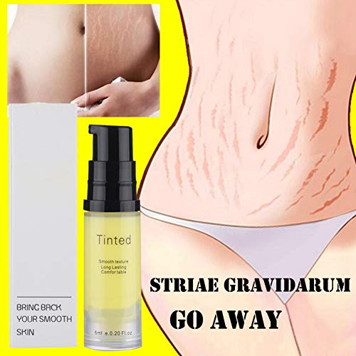 Crema para estrías Crema para estrías Crema para arrugas y estrías, Reparar cicatriz Línea floja Abdomen Estrías, Pigmento aclarador Eliminar Estrías Cuidado de la piel Crema esencial