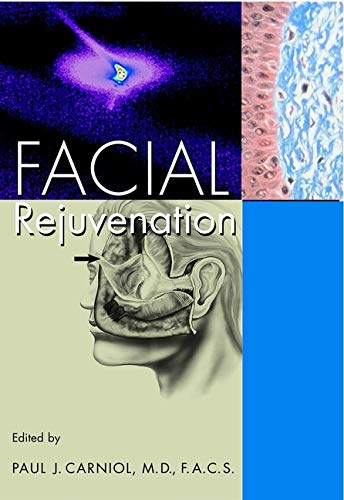 FACIAL REJUVENATION: From Chemical Peels to Laser Resurfacing (Wiley-Liss Publication)