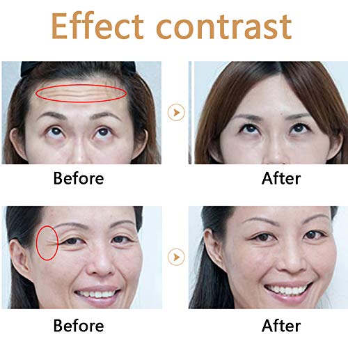 FDCXK Hyaluron Pen Hialurónica con Cabeza De 10 Ampollas para El Llenado De Antiarrugas Lifting Dudu Lips Atomizer Pen