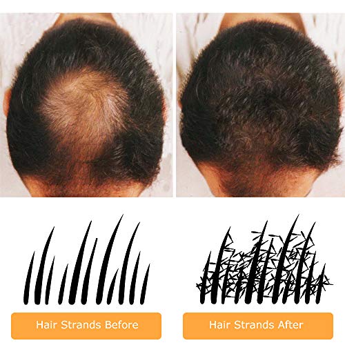 Fibras Capilares Natural Negro 28 Gramos Caída Cabello Disimular Calvicie Con Polvo de Queratina Aumentar el Volumen Hombre Mujer