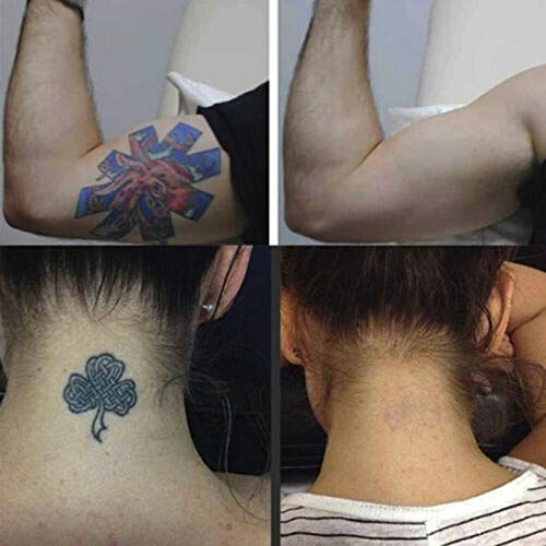 ieenay Crema de eliminación de Tatuajes Permanente No es Necesario Eliminar el Dolor Fuerza máxima