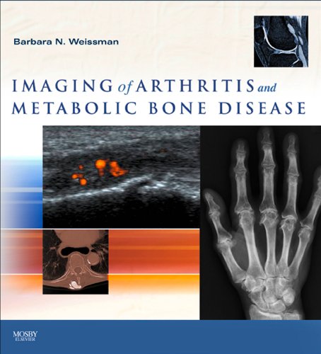 Imaging of Arthritis and Metabolic Bone Disease E-Book: Expert Consult - Online and Print (Expert Consult Title: Online + Print) (English Edition)